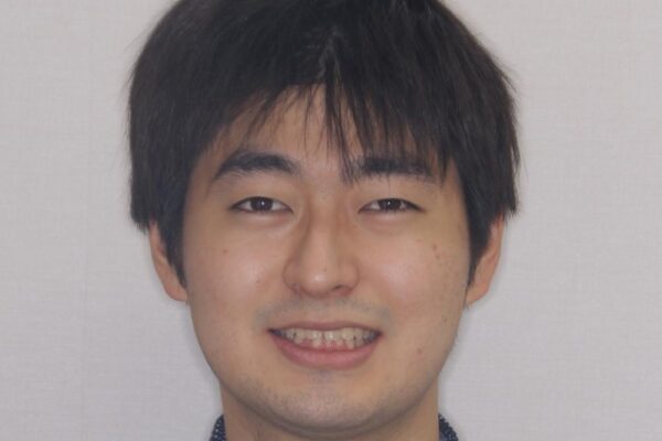 【モニター】飛び出した上の前歯　ワイヤー装置を併用してインビザラインできれいに 治療前画像